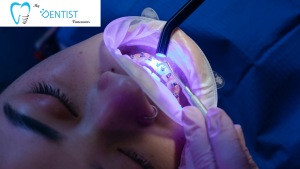 teeth whitening in Vancouver